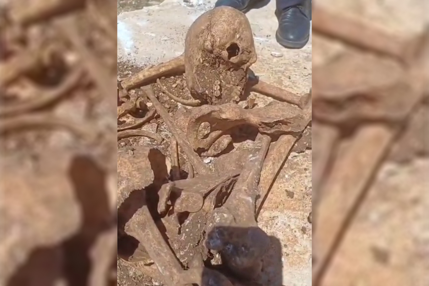 Malatya'da TOKİ inşaatı kazısında insan kemikleri bulundu