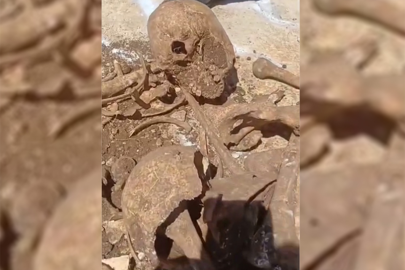 Malatya'da TOKİ inşaatı kazısında insan kemikleri bulundu