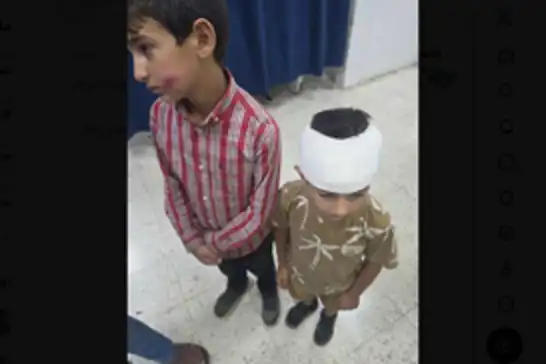 در حمله شهرک‌نشینان یهودی ۲ کودک فلسطینی زخمی شدند
