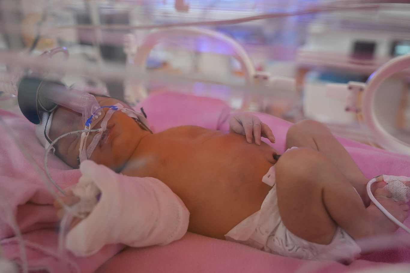 MEAH'ın Tüp Bebek Ünitesi'nin ilk bebekleri dünyaya geldi